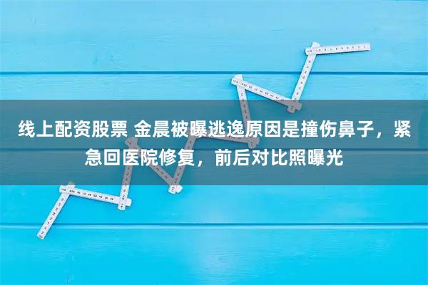 线上配资股票 金晨被曝逃逸原因是撞伤鼻子，紧急回医院修复，前后对比照曝光